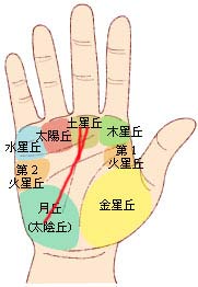 ŵ